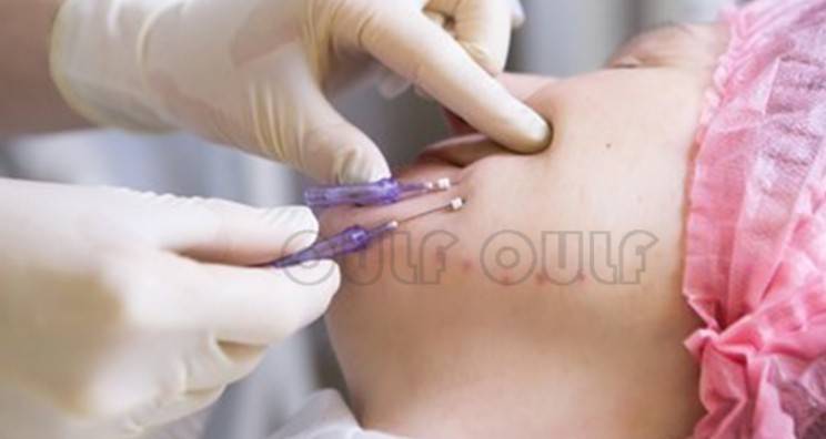 線雕最新手法，背景、發(fā)展、時代地位及展望